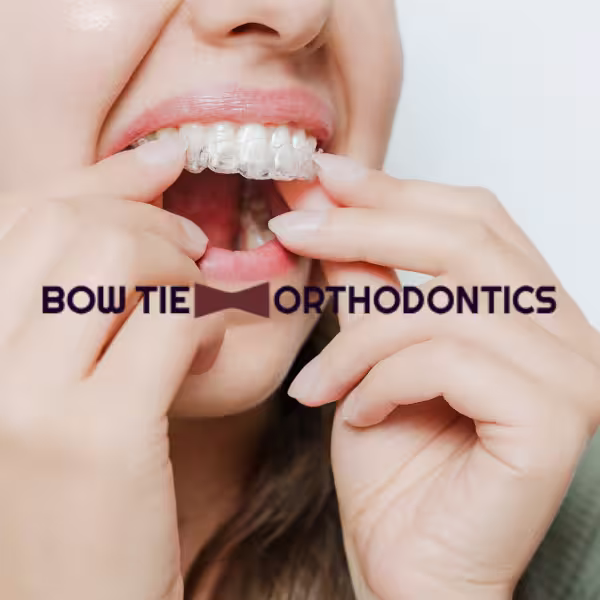 clear aligners for adults